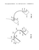 Patient Selectable Joint Arthroplasty Devices and Surgical Tools diagram and image