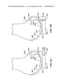 Patient Selectable Joint Arthroplasty Devices and Surgical Tools diagram and image