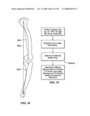 Patient Selectable Joint Arthroplasty Devices and Surgical Tools diagram and image