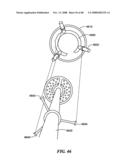 Patient Selectable Joint Arthroplasty Devices and Surgical Tools diagram and image