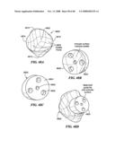 Patient Selectable Joint Arthroplasty Devices and Surgical Tools diagram and image