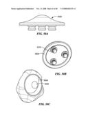 Patient Selectable Joint Arthroplasty Devices and Surgical Tools diagram and image