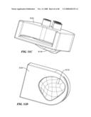 Patient Selectable Joint Arthroplasty Devices and Surgical Tools diagram and image