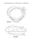 Patient Selectable Joint Arthroplasty Devices and Surgical Tools diagram and image