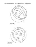 Patient Selectable Joint Arthroplasty Devices and Surgical Tools diagram and image