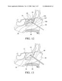 Balloon catheters and methods for treating paranasal sinuses diagram and image
