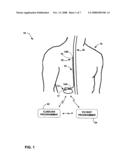 Multi-location posture sensing diagram and image