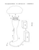 METHODS AND DEVICES FOR TREATING TISSUE diagram and image