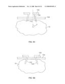 METHODS AND DEVICES FOR TREATING TISSUE diagram and image