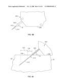 METHODS AND DEVICES FOR TREATING TISSUE diagram and image