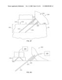 METHODS AND DEVICES FOR TREATING TISSUE diagram and image