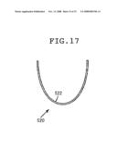 GUIDE WIRE AND STENT diagram and image