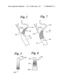 STENT HAVING VARIABLE PROPERTIES AND METHOD OF ITS USE diagram and image