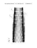 STENT HAVING VARIABLE PROPERTIES AND METHOD OF ITS USE diagram and image