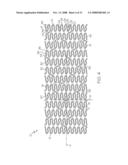 Stent Configurations diagram and image