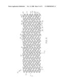 Stent Configurations diagram and image