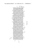 Stent Configurations diagram and image