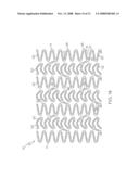 Stent Configurations diagram and image