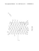 Stent Configurations diagram and image