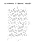 Stent Configurations diagram and image