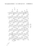 Stent Configurations diagram and image