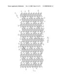 Stent Configurations diagram and image