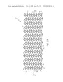 Stent Configurations diagram and image