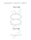 Intraocular ring assembly and artificial lens kit diagram and image