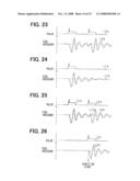 INJECTION CHARACTERISTIC DETECTION APPARATUS, CONTROL SYSTEM, AND METHOD FOR THE SAME diagram and image