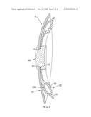 Protective hip pad diagram and image