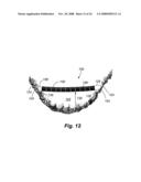 SOLAR ARRAY SUPPORT METHODS AND SYSTEMS diagram and image