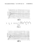 SEISMIC STREAMER WITH IRREGULARLY SPACED HYDROPHONES diagram and image