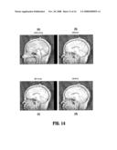 System and Method for Consistent Detection of Mid-Sagittal Planes for Magnetic Resonance Brain Scans diagram and image