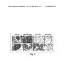 Methods of Detecting Ovarian Cancer diagram and image