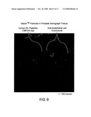 Delivery of micro- and nanoparticles with blood platelets diagram and image