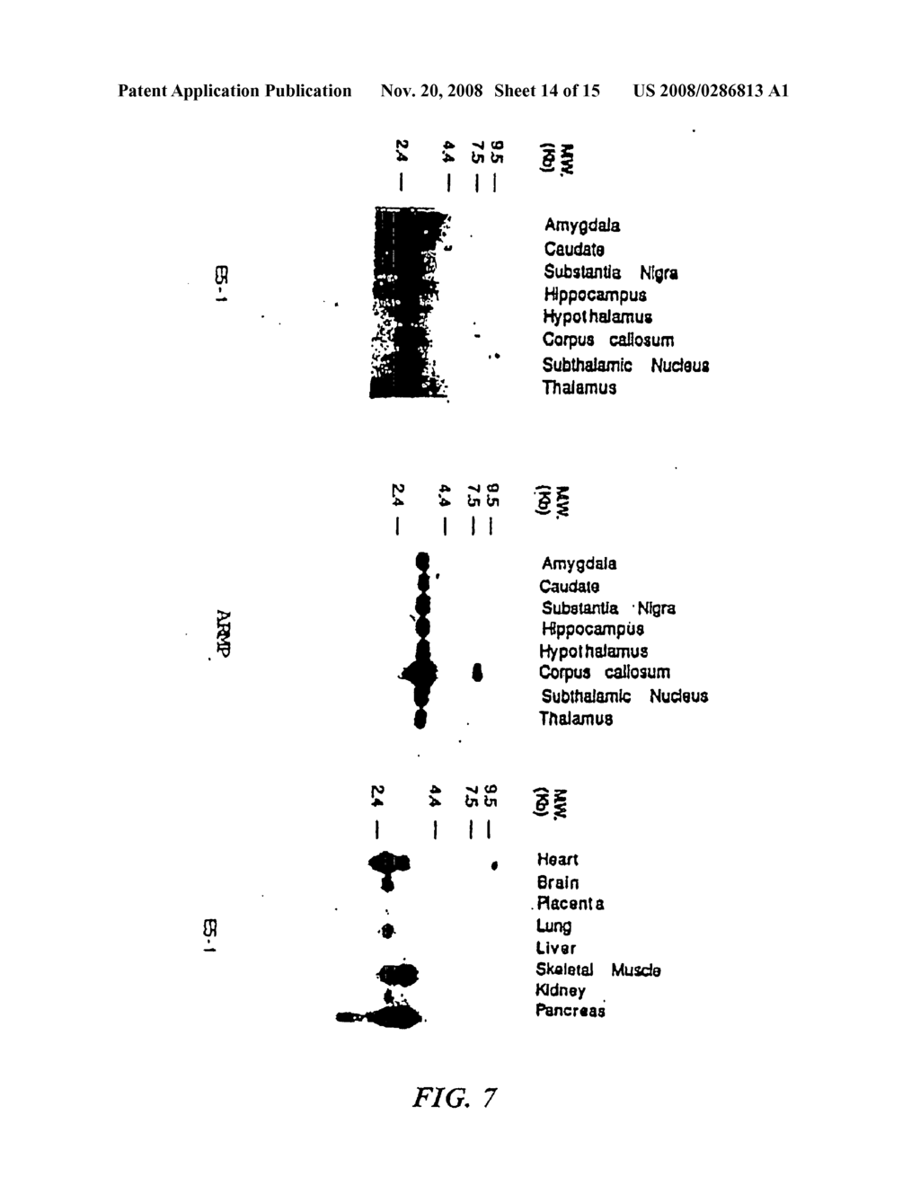 Antibody specific for mutant presenilin 1 and method of use thereof - diagram, schematic, and image 15