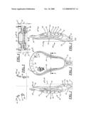 LACROSSE HEAD WITH SIDEWALLS OF ASYMMETRICAL HEIGHT diagram and image