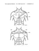 METHOD AND APPARATUS FOR TORSO MUSCLE LENGTHENING diagram and image