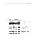 Compositions and Methods Relating to Protein Kinase Inhibitors diagram and image