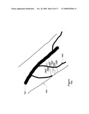 Scanned laser vein contrast enhancer diagram and image