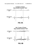 DEVICES AND METHODS FOR ASSESSING MOTOR POINT ELECTROMYOGRAM AS A BIOMARKER diagram and image