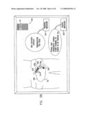 Non-invasive ultrasonic body contouring diagram and image