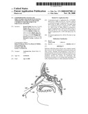 Ethmoidotomy System and Implantable Spacer Devices Having Therapeutic Substance Delivery Capability for Treatment of Paranasal Sinusitis diagram and image