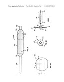 Ethmoidotomy System and Implantable Spacer Devices Having Therapeutic Substance Delivery Capability for Treatment of Paranasal Sinusitis diagram and image