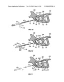 Ethmoidotomy System and Implantable Spacer Devices Having Therapeutic Substance Delivery Capability for Treatment of Paranasal Sinusitis diagram and image