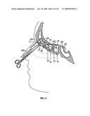 Ethmoidotomy System and Implantable Spacer Devices Having Therapeutic Substance Delivery Capability for Treatment of Paranasal Sinusitis diagram and image