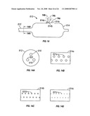 Ethmoidotomy System and Implantable Spacer Devices Having Therapeutic Substance Delivery Capability for Treatment of Paranasal Sinusitis diagram and image