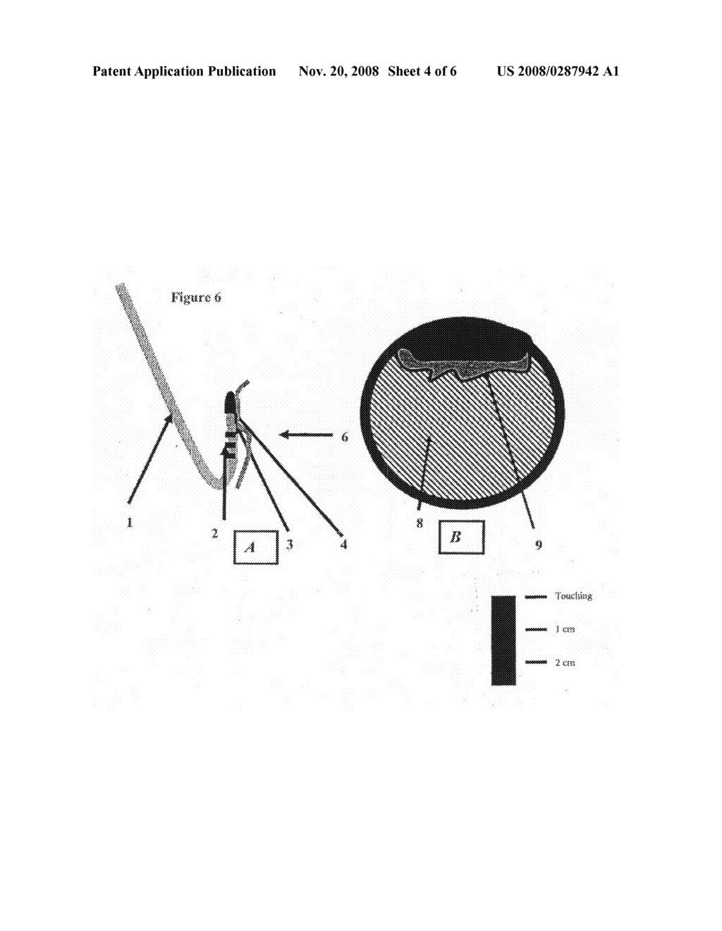 RF Ablation Catheter with Side-Eye Infrared Imager - diagram, schematic, and image 05