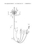 TISSUE ABLATION APPARATUS AND METHOD diagram and image