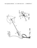 TISSUE ABLATION APPARATUS AND METHOD diagram and image